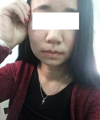 "简单有效又快速的祛痘方法 如何面对这三年来的抗痘"