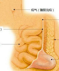 "40天宝宝有小肠气怎么办?如何预防小儿疝气?"