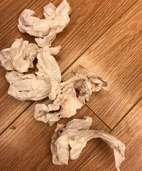 20个月宝宝嘴唇系带摔断裂,请问是否可以长合?