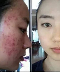 深圳市仁医堂皮肤医学研究院:别被这些奇怪的护肤祛痘理论洗脑了