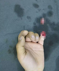 今早,杭州6岁男孩手指被校服裤腰带勒断!妈妈急哭了