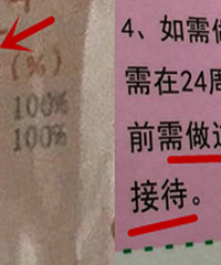 这医院挂号费一百!不排畸就不给做四维