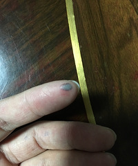 手指指腹被夹出紫黑色的肿块,能自己恢复吗?