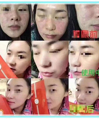 快看看你买的面膜,有这种情况,赶紧扔掉!