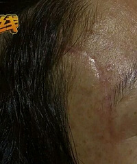 女子在萧山坐滴滴遭遇车祸,脸上留下8公分的疤!谁来赔?