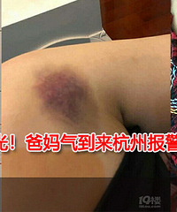 17岁女生因打呼噜,被8个同学暴打!
