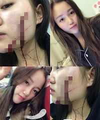 美女被合租女生带回的男生砍毁容