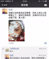昨夜,杭州漂亮小姑娘被紧急送医!左眼被伤,还带倒刺!