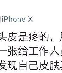 满脸长疱疹的马思纯还想着工作,是在作秀吗?