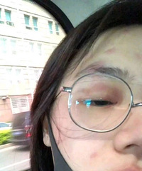满脸长疱疹的马思纯还想着工作,是在作秀吗?