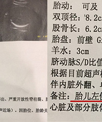 要引产?求分析!胎儿后角宽,要紧吗?
