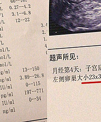 子宫小甲亢会流产?医生:他这治不了!