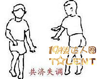 共济失调的家人注意了-否则晚年遭罪