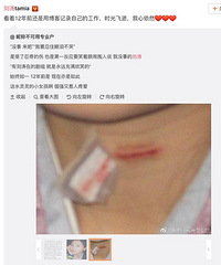 刘涛12年前因拍戏被划伤脖子,血流不止崩溃大哭