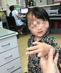 5岁女孩要到杭州“换脸”