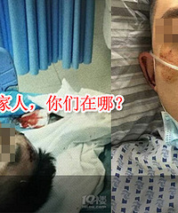 急寻!杭州24岁小伙遇车祸脑部受伤了