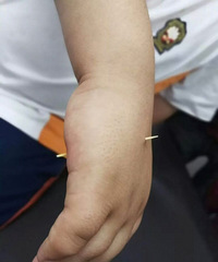 看着都疼!牙签直立桌子上,熊孩子不小心一掌拍下去,扎穿了