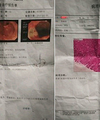 帮我看看母亲的胃病严重吗?担心担心…