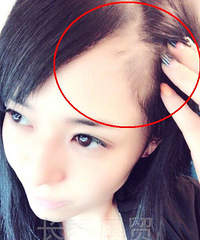苍井空素颜近照曝光 疑似脱发众网友支招