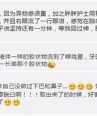 这年头矫牙都不用取模了,百万级网红也向黑科技低头