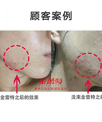 祛痘美容院,美容不成,倒成毁容了,你是否也有这样的经历?