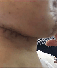 【医患故事】表妹就是你们治好的,所以我也来抓药了!