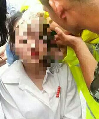 ������Ѫֱ��������������ɡ�����Ƥ��