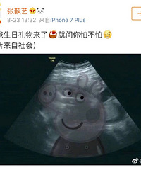 张歆艺怀孕!晒个B超照都这么社会,这个妈妈很皮呀