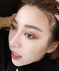 纹发际线效果能够维持多久?