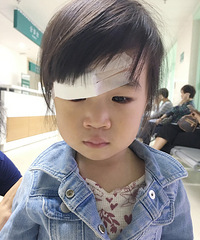 宝宝眼睛上有一个小小的包,没去在意没想到后果这么严重