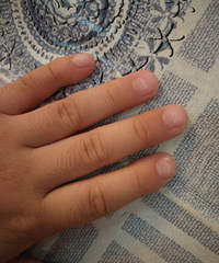 [����]С��ָ�״Ӹ����Ѳ���ʲôԭ��