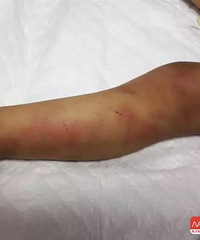 ��ŭ������ĸ������Ű����1��Ůͯ�������ˣ�ҽ��˵�Ȼ������㣡