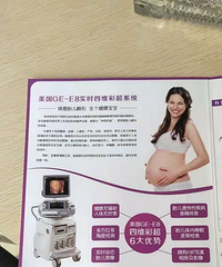 产检正常宝宝出生畸形