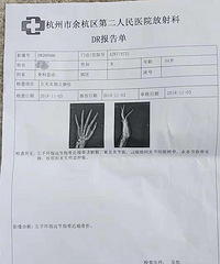 ��Χ����ͯ�������˲�ǣ�������������Ű���ͯ�����������