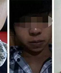 成都M微笑唇与厚唇改薄有什么区别