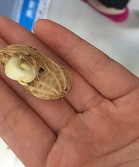 发芽的食物到底哪个能吃,哪个有剧毒?