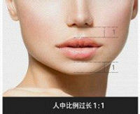 成都人中缩短手术怎么样?