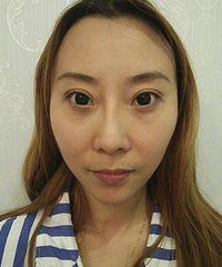 重庆自体脂肪面部填充有哪些医生比较擅长?