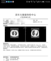 关于乳腺斑点状钙化灶的咨询。