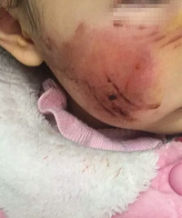 ������ͯ�����ձ���ҧ�ò�����Ŀ���ְ�˵��