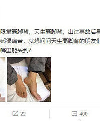黄晓明晒脚背照回应鞋垫质疑! 哎 ,看着好心疼啊
