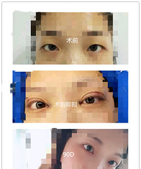 ˫��Ƥ���Ŀ�����