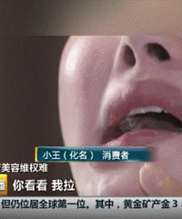 25岁女孩整容成歪嘴:毁了我一生!医院只赔5000元