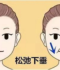 李晓东pst面部提升,有效解决面部松弛问题!