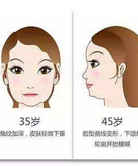 李晓东PST面部提升抗衰吗?抗衰大科普!