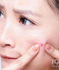 长痘20天痘印消两年,对付颜值杀手老祖宗的办法绝了