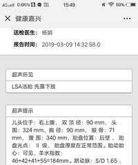 本人信佛 不想在身上动刀 38周坚持要顺产风险大吗