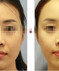 �Ǵ��������ƾ��� ���� ������PST�沿