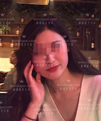 李晓东PST面部提升案例 组图来了