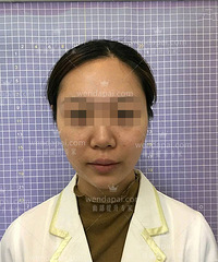 北京面部皮肤松弛怎么办?李晓东PST埋线提升来改善!